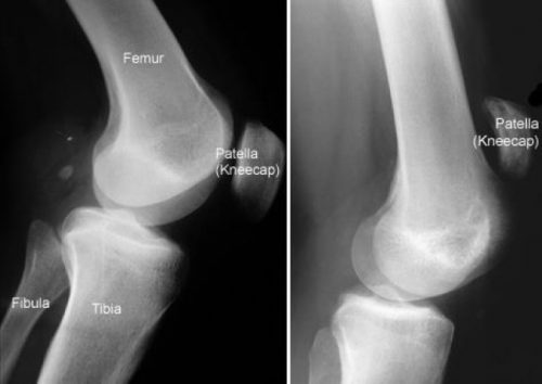1526044803-6535-don-patella-Credit-orthoinfo
